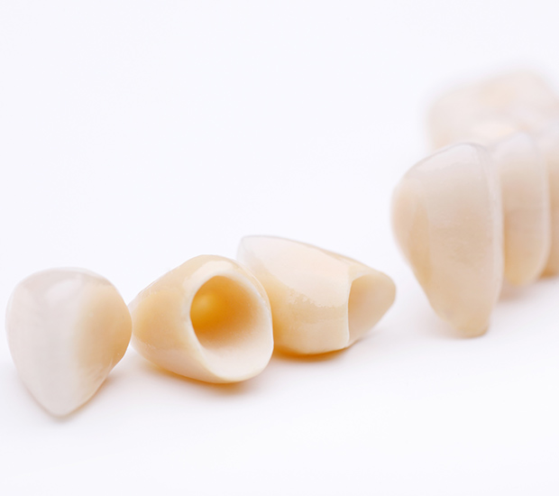 Cranford Dental Crowns and Dental Bridges