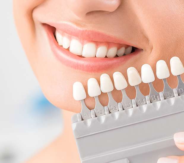 Cranford Dental Veneers and Dental Laminates