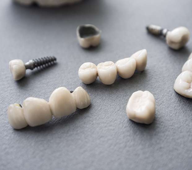 Cranford The Difference Between Dental Implants and Mini Dental Implants